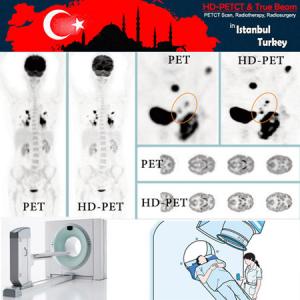 PET-CT و PET Scan (رادیوتراپی - پرتودرمانی) در ترکیه  PET-CT